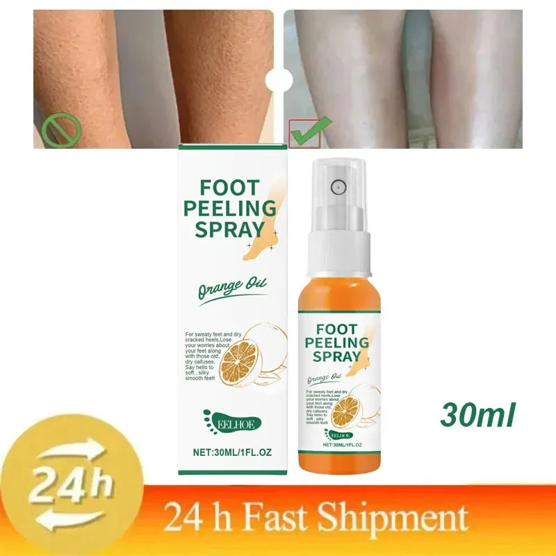 Herbal Anti Crack Foot Cream Peeling Spray Heel Cracking Repair Products Exfoliation Dead Skin Removal Softening Smooth Care