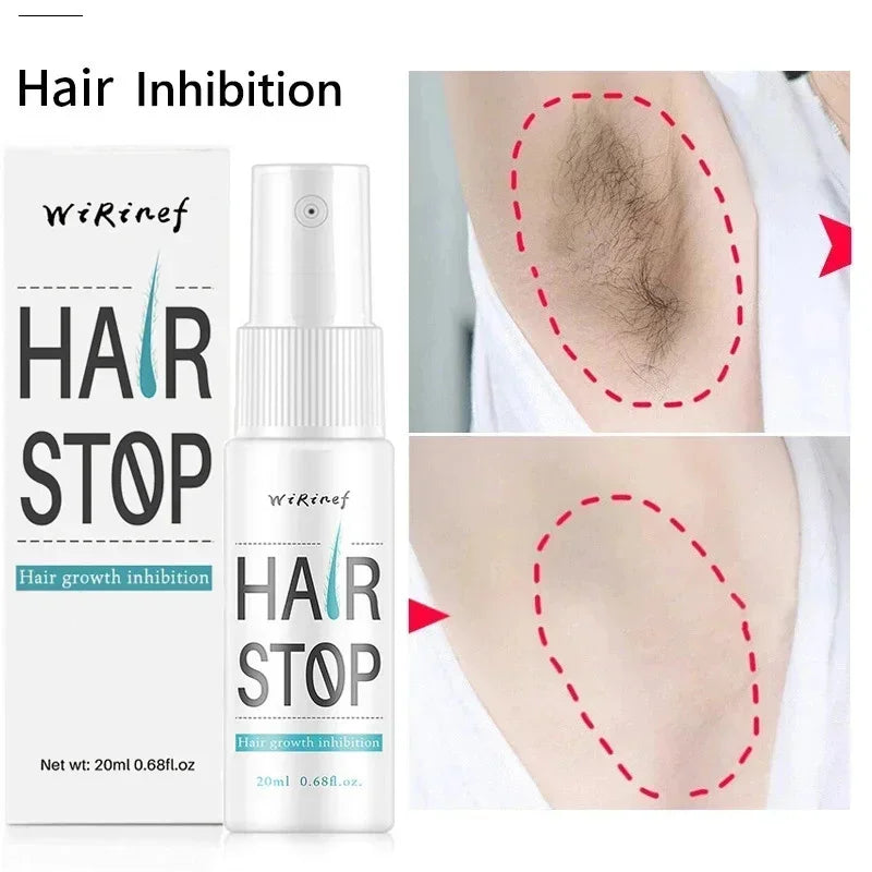 Fast Hair Removal Spray Painless Hair Growth Inhibitor Remove Armpit Leg Arm Permanent Depilatory for Men Women Repair Body Care