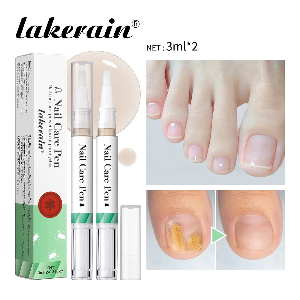 1/2pc Nail Care Mild Ingredients Prevent Damaged Nail Bed Treat Onychomycosis Nail Repair Pen For Nail Beauty Health Care Tools