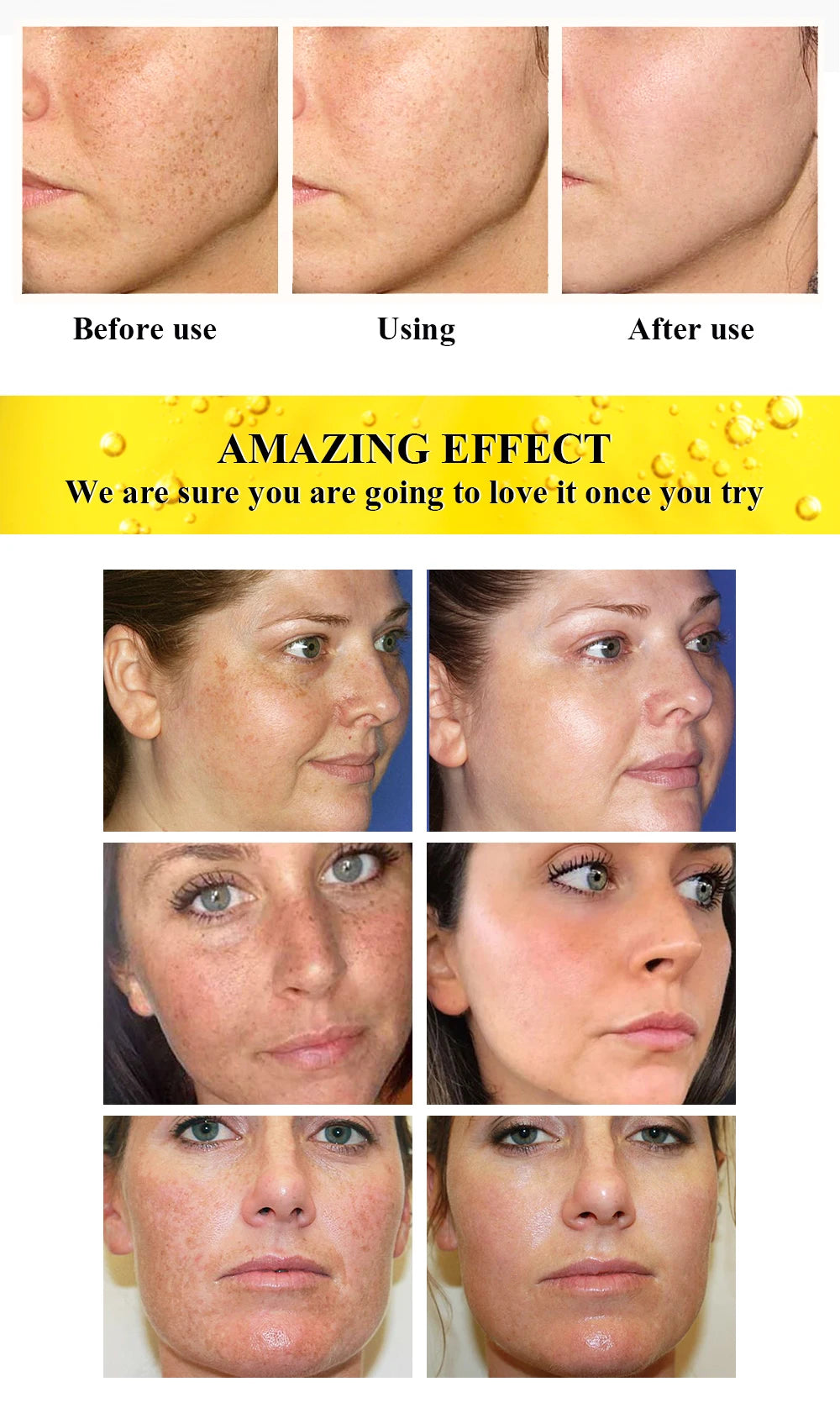 AILKE Carotene 3-In-1 Skin Care Set, Clean Skin With Niacinamide, Antioxidant, Improves Dull Skin For All Skin Types