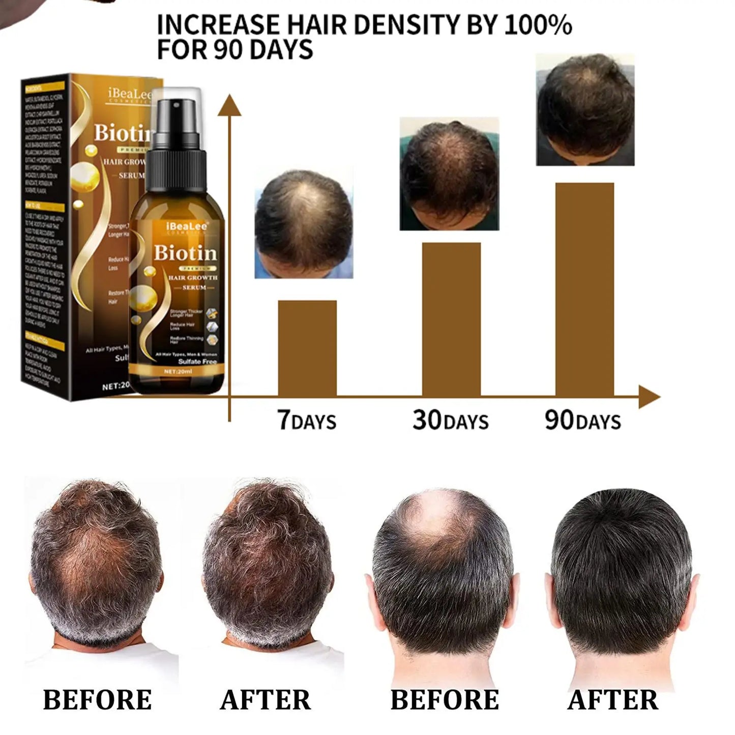 Hair Thickening Care Products Scalp Repair Hair Thicken Conditioner Beard Thickening Care Oil Serum Professional Hair Care
