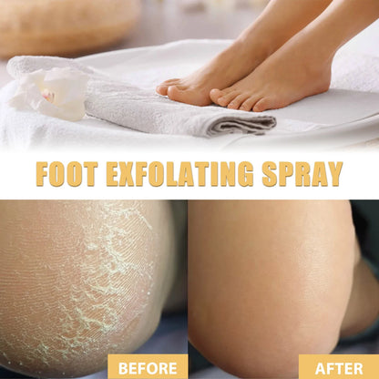 WhiteningFoot Exfoliating Spray Moisture Lock Callus Softener Anti Dry Crack Repair Odor Control Brightening Foot Care Liquid