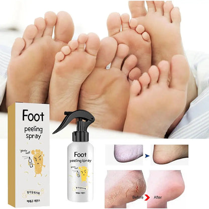Foot Callus Remover Spray Quickly Soften Calluses Exfoliation Dry Feet Skin Hydrating clean Dead repair Skin cuticles Foot Care