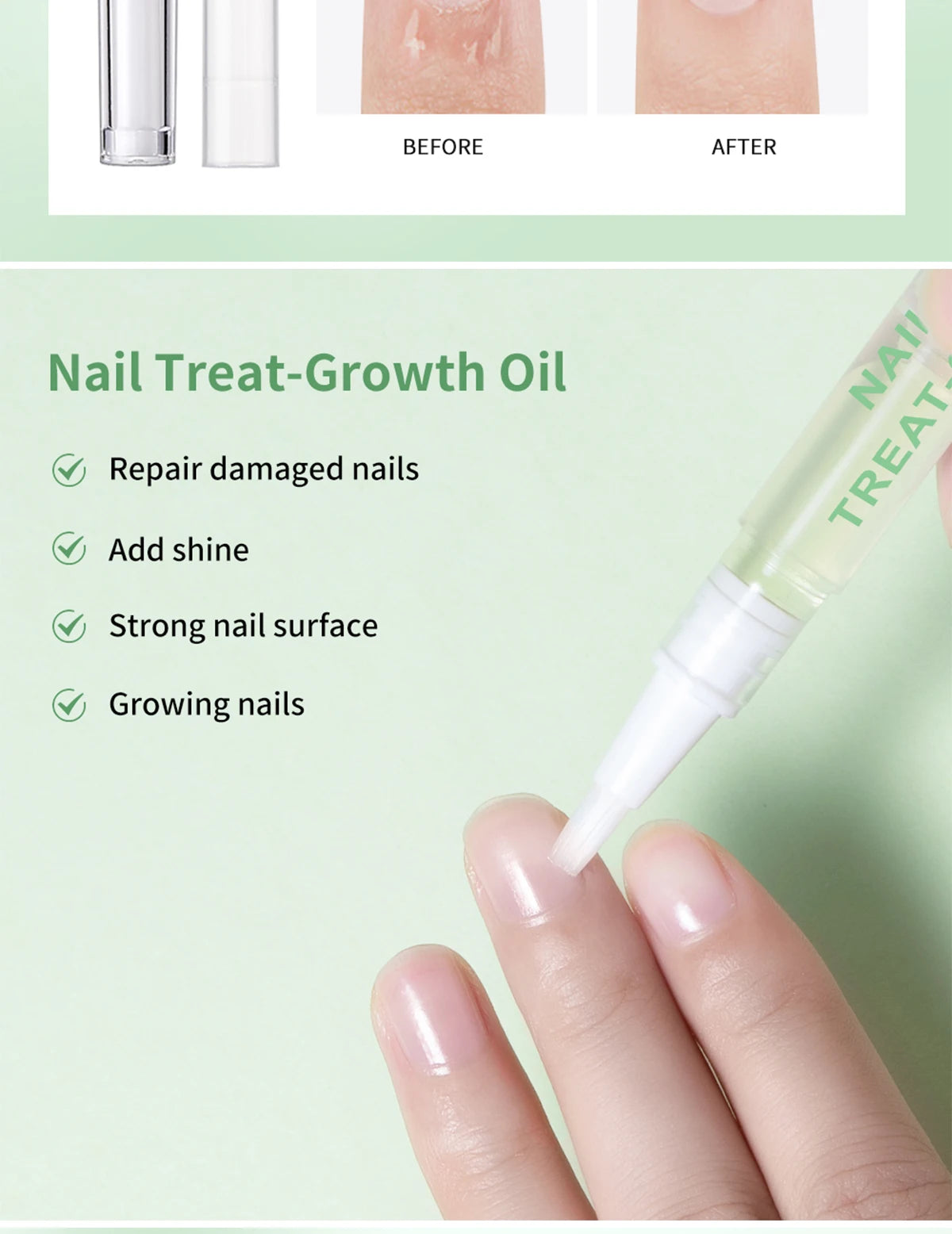 Nail Treat-Growth Oil Nail Nutrition Oil Pen Nail Treatment Cuticle Revitalizer Oil Prevent Nail Polish Agnail Nourish Skin