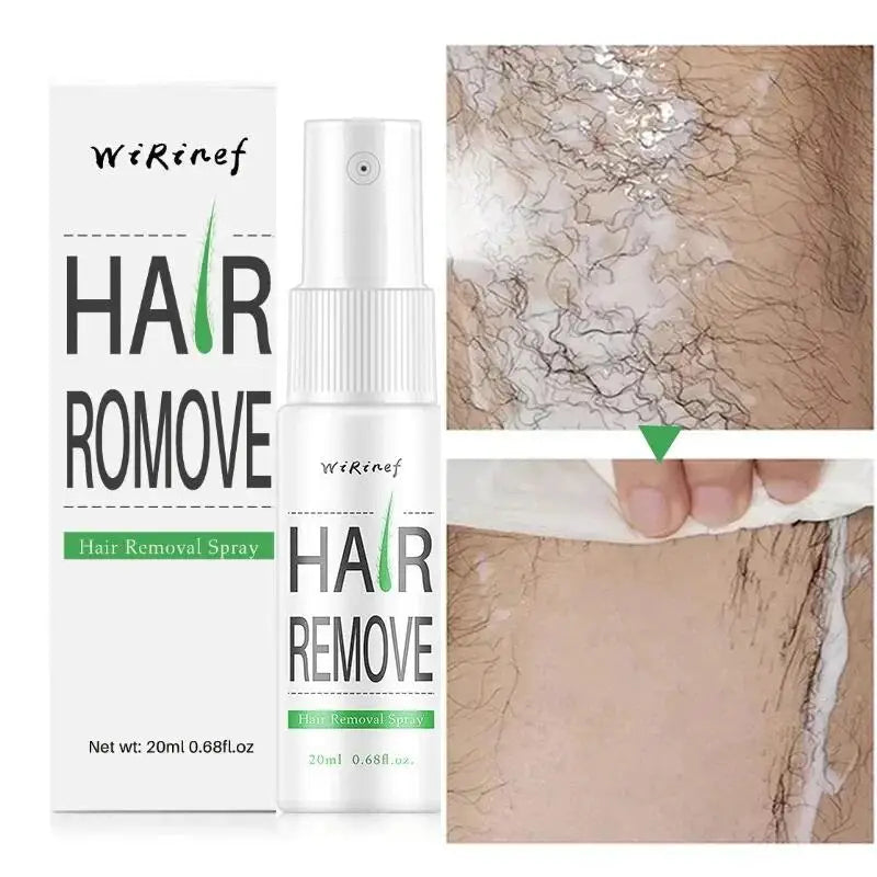 Fast Hair Removal Spray Painless Hair Growth Inhibitor Remove Armpit Leg Arm Permanent Depilatory for Men Women Repair Body Care