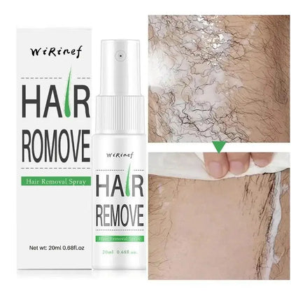 Fast Hair Removal Spray Painless Hair Growth Inhibitor Remove Armpit Leg Arm Permanent Depilatory for Men Women Repair Body Care