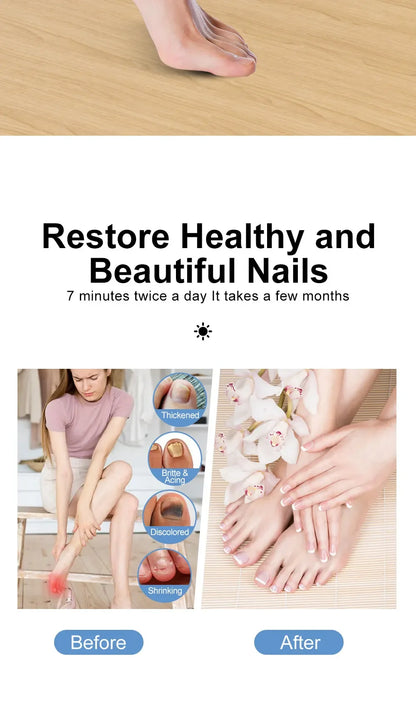 Nails Fungus Laser Treatment Device Rechargeable UV Lamp Fingernails Toenails Onychomycosis Therapy Sterilize Repair Care Tools