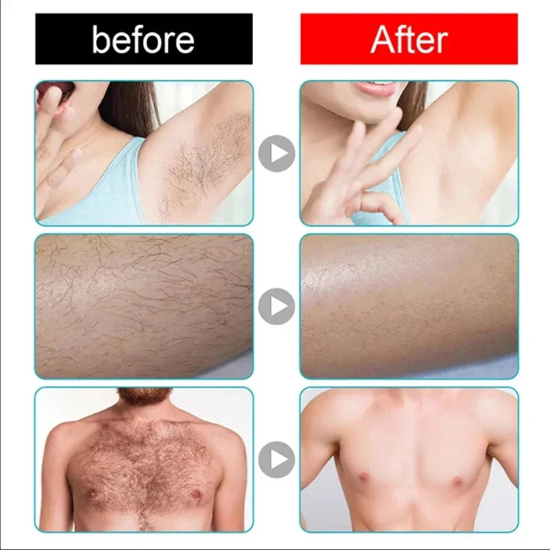 Fast Hair Removal Spray Painless Hair Growth Inhibitor Remove Armpit Leg Arm Permanent Depilatory for Men Women Repair Body Care