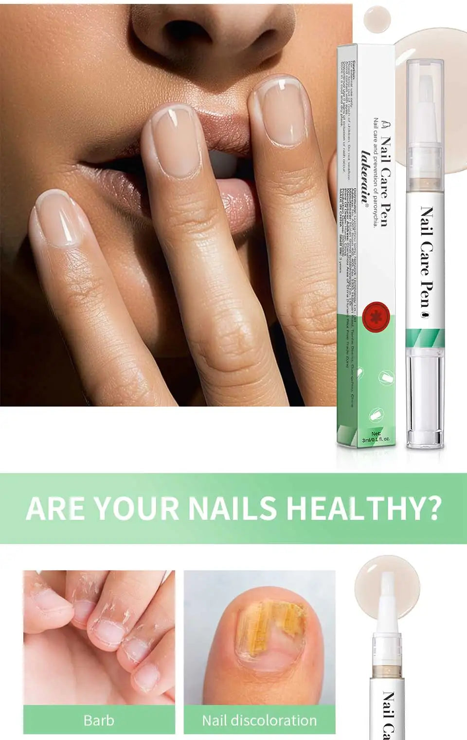 1/2pc Nail Care Mild Ingredients Prevent Damaged Nail Bed Treat Onychomycosis Nail Repair Pen For Nail Beauty Health Care Tools