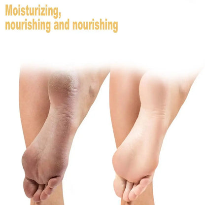 Foot Callus Remover Spray Quickly Soften Calluses Exfoliation Dry Feet Skin Hydrating clean Dead repair Skin cuticles Foot Care