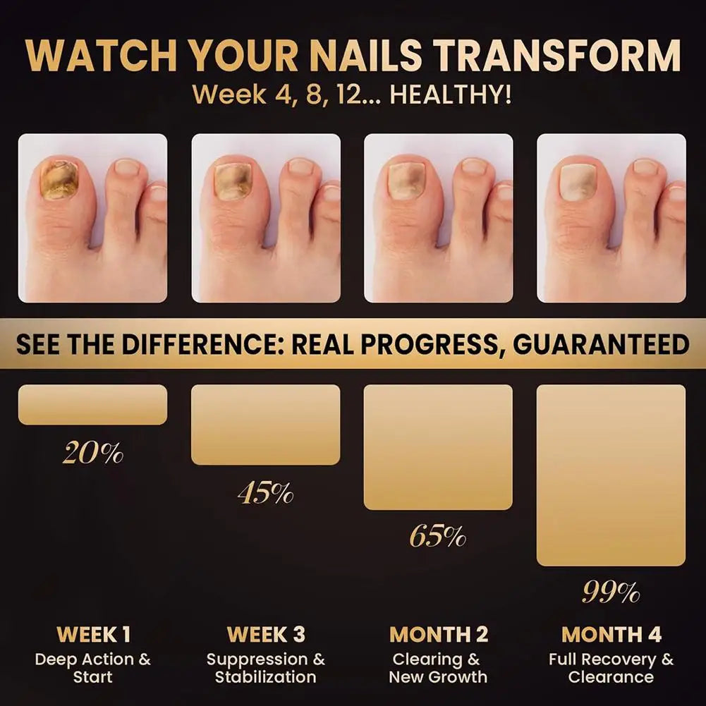 1 Box/4pcs Nail Fungal Liquid Fast Onychomycosis Fungus Nails care pen