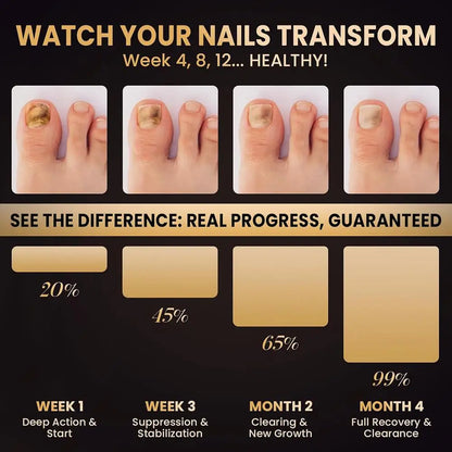 1 Box/4pcs Nail Fungal Liquid Fast Onychomycosis Fungus Nails care pen