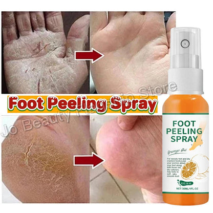 Herbal Anti Crack Foot Cream Peeling Spray Heel Cracking Repair Products Exfoliation Dead Skin Removal Softening Smooth Care
