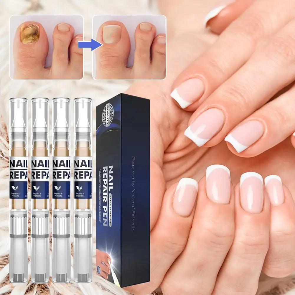 1 Box/4pcs Nail Fungal Liquid Fast Onychomycosis Fungus Nails care pen