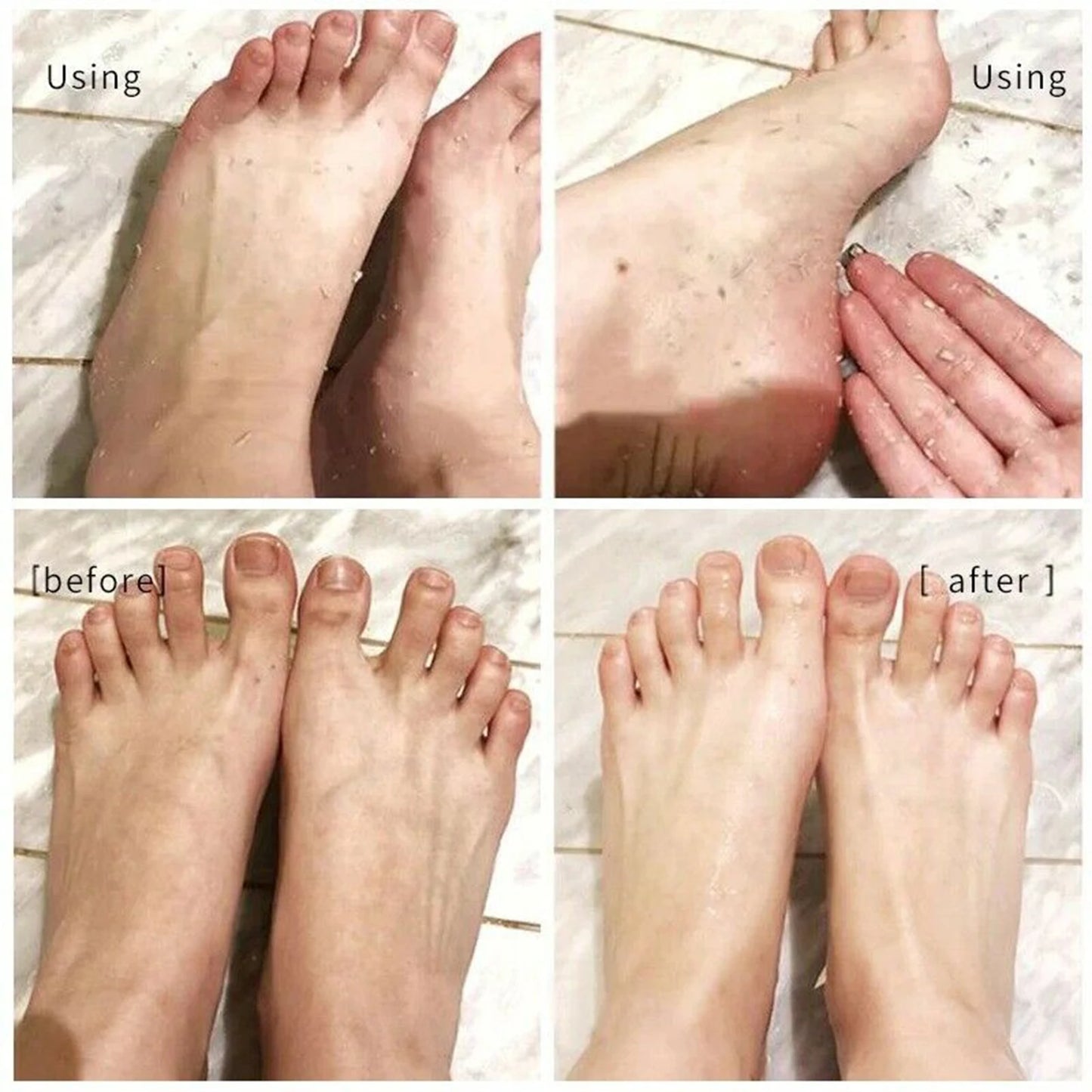 110ML Foot Peeling Spray  Improve Rough Skin Available For Whole Body