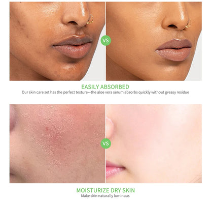 Multi-skin Care Aloe Vera Skin Care Set Deep Moisturizing Deep Nourishment Whitening Brightening Hydrating Smooth Skin