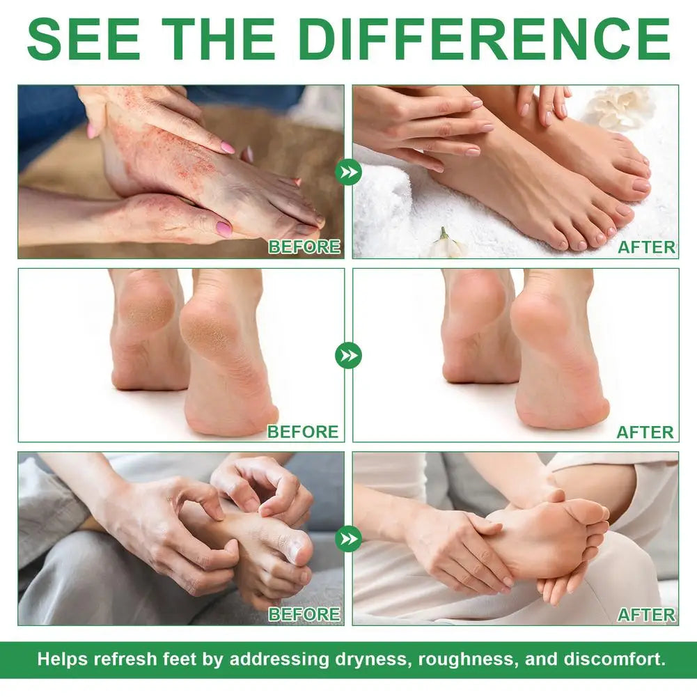 100ml Foot Deodorization Spray Removal Odor with Tea Tree Oil Foot Sanitizer Spray Moisturize Foot Drying Foot Odor Deodorant