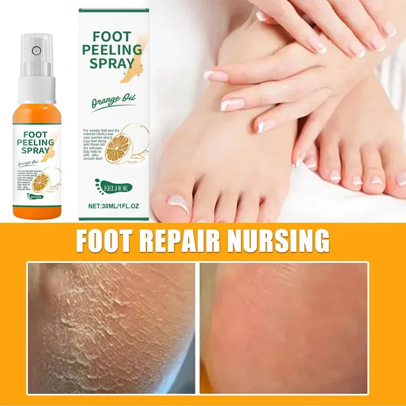 Herbal Anti Crack Foot Cream Peeling Spray Heel Cracking Repair Products Exfoliation Dead Skin Removal Softening Smooth Care