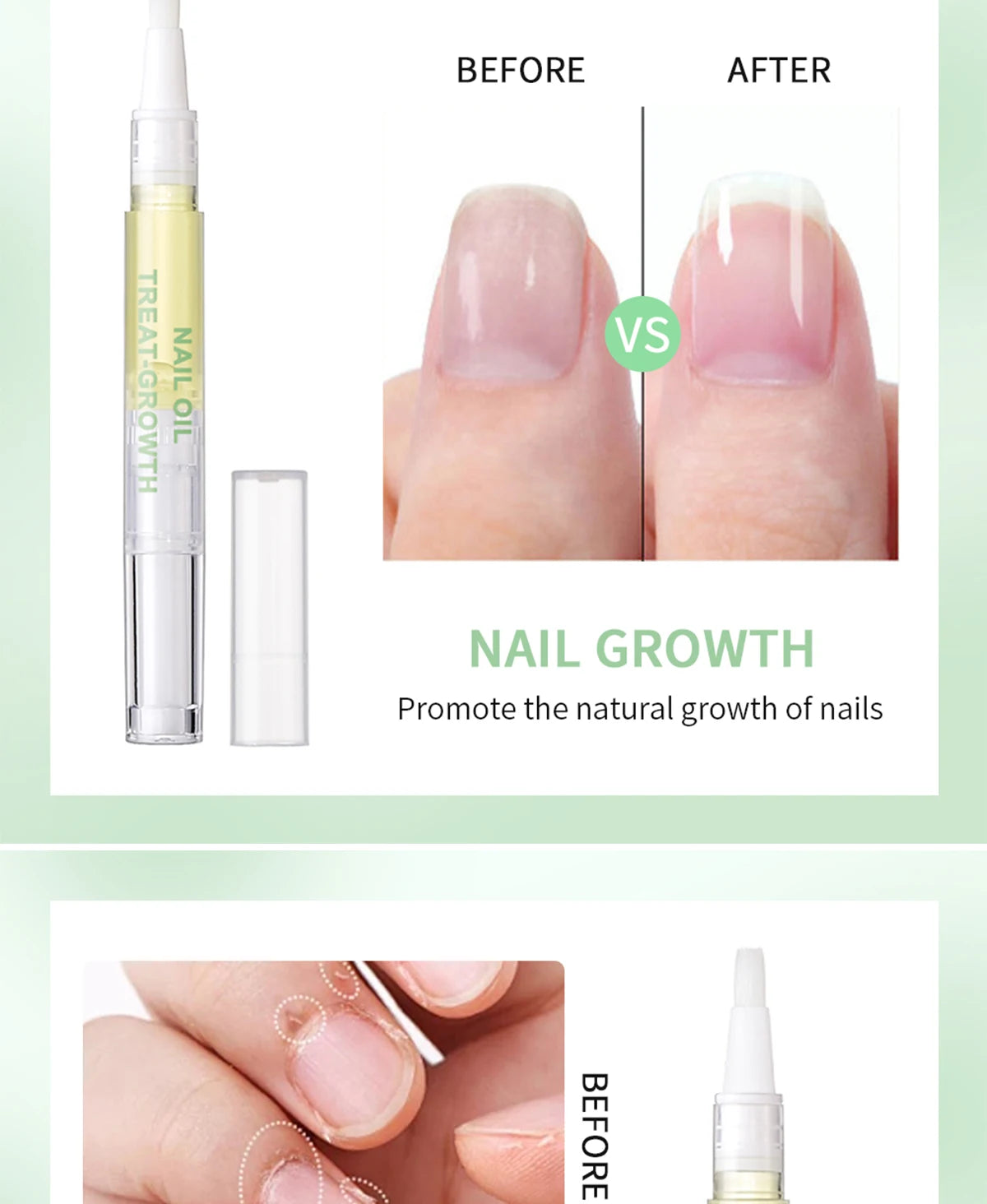 Nail Treat-Growth Oil Nail Nutrition Oil Pen Nail Treatment Cuticle Revitalizer Oil Prevent Nail Polish Agnail Nourish Skin