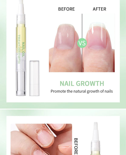 Nail Treat-Growth Oil Nail Nutrition Oil Pen Nail Treatment Cuticle Revitalizer Oil Prevent Nail Polish Agnail Nourish Skin
