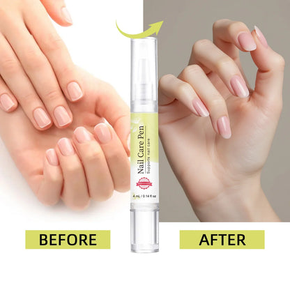 Nail Strengthening Pen 4ml - Lemon & tea tree oil blend minimizes yellow stains, fortifies weak nails & hydrates nail edges.