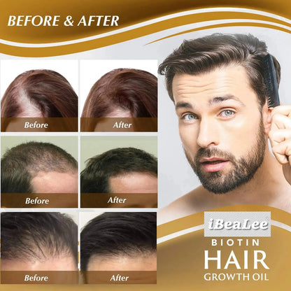 Scalp Repair Hair Thicken Conditioner Hair Thickening Care Products Beard Thickening Care Oil Serum Professional Hair Care