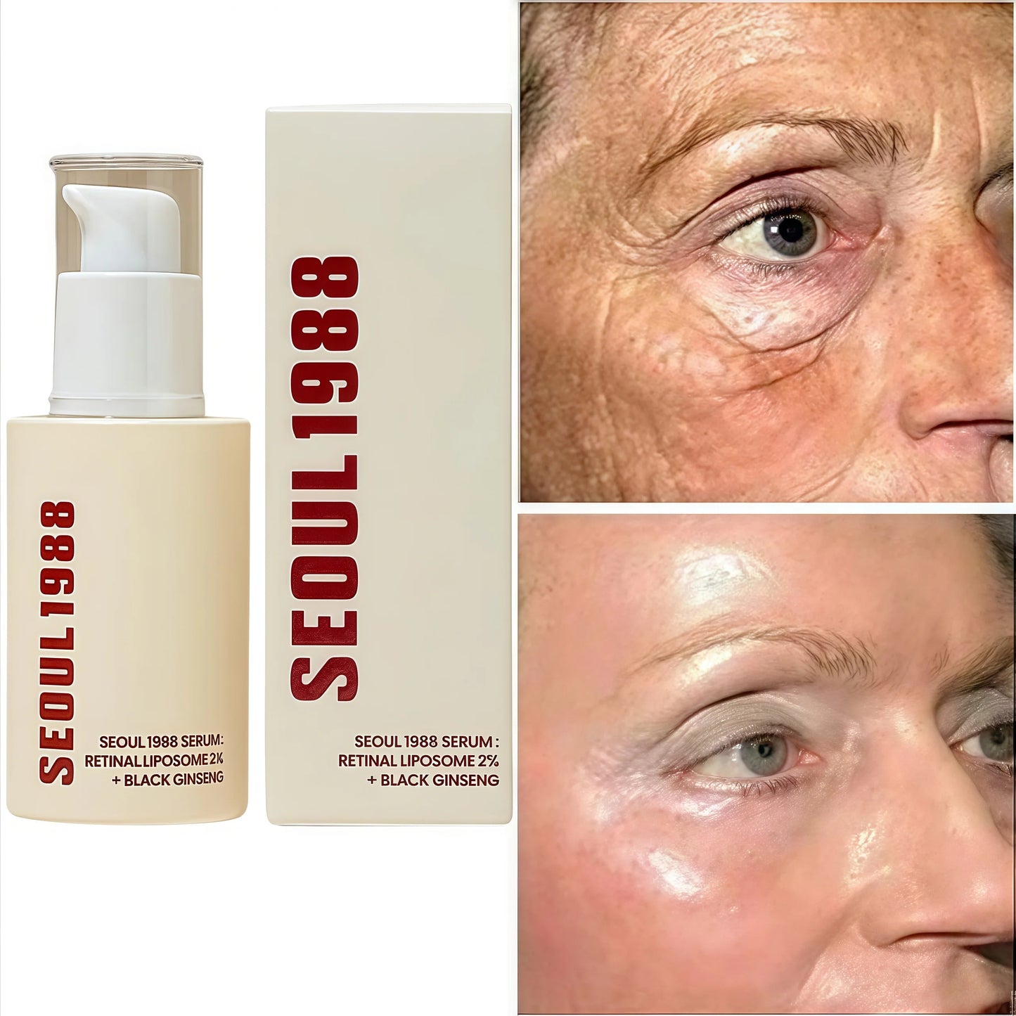 SEOUL 1988 Eye Cream Niacinamide 2% Retinal Acid Ginseng Serum Lighten Fine Lines Firming Pores Brightening Face Korean Skincare