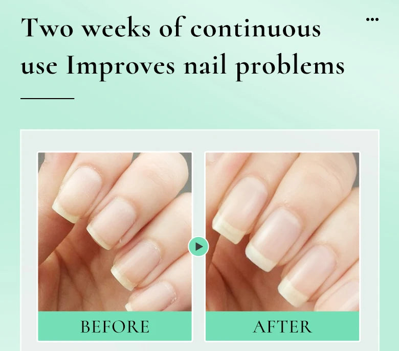 Nail Nourishment Cuticle Oil Pen Gel Suitable Hand/Feet Vitamin E Finger Nails Treatment Serum Nail Care