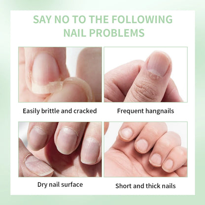 Nail Treat-Growth Oil Nail Nutrition Oil Pen Nail Treatment Cuticle Revitalizer Oil Prevent Nail Polish Agnail Nourish Skin