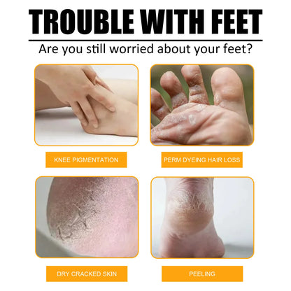 Herbal Anti Crack Foot Cream Spray Heel Cracking Repair Products Exfoliation Dead Skin Removal Softening Moisturize Smooth Care