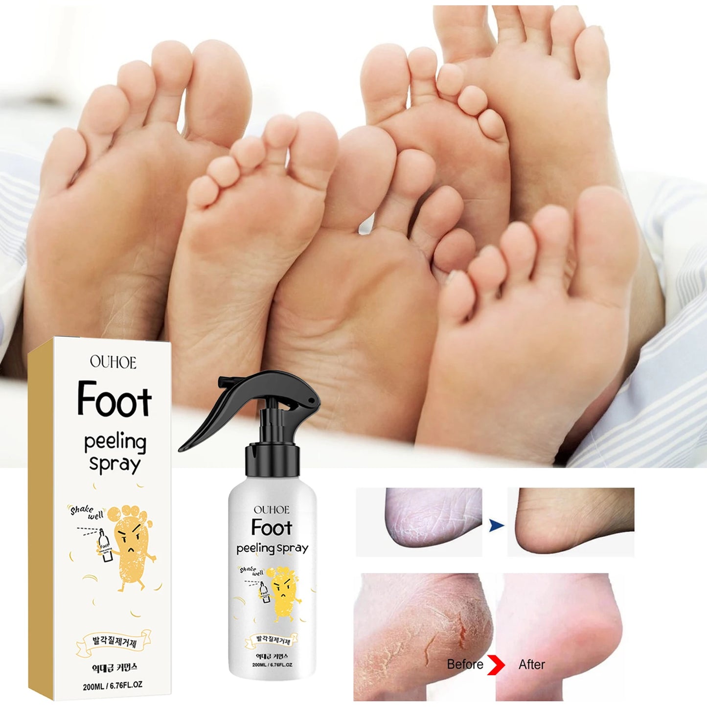 Foot Callus Remover Spray Quickly Soften Calluses Exfoliation Dry Feet Skin Hydrating clean Dead repair Skin cuticles Foot Care