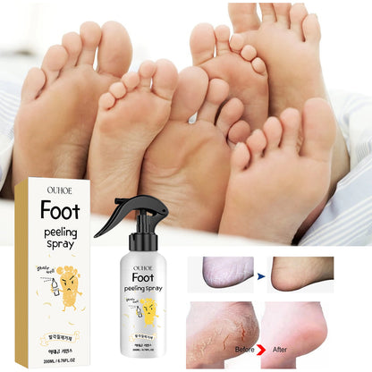 Foot Callus Remover Spray Quickly Soften Calluses Exfoliation Dry Feet Skin Hydrating clean Dead repair Skin cuticles Foot Care