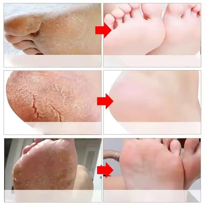 Herbal Anti Crack Foot Cream Spray Heel Cracking Repair Products Exfoliation Dead Skin Removal Softening Moisturize Smooth Care