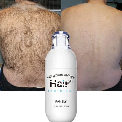 Hair Removal Spray Hair Growth Inhibitor Spray Painless Hair Reduction Permanently Inhibits Hair Growth Skin Silky Smooth 100ML