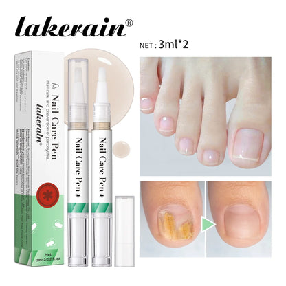 1/2pc Nail Care Mild Ingredients Prevent Damaged Nail Bed Treat Onychomycosis Nail Repair Pen For Nail Beauty Health Care Tools