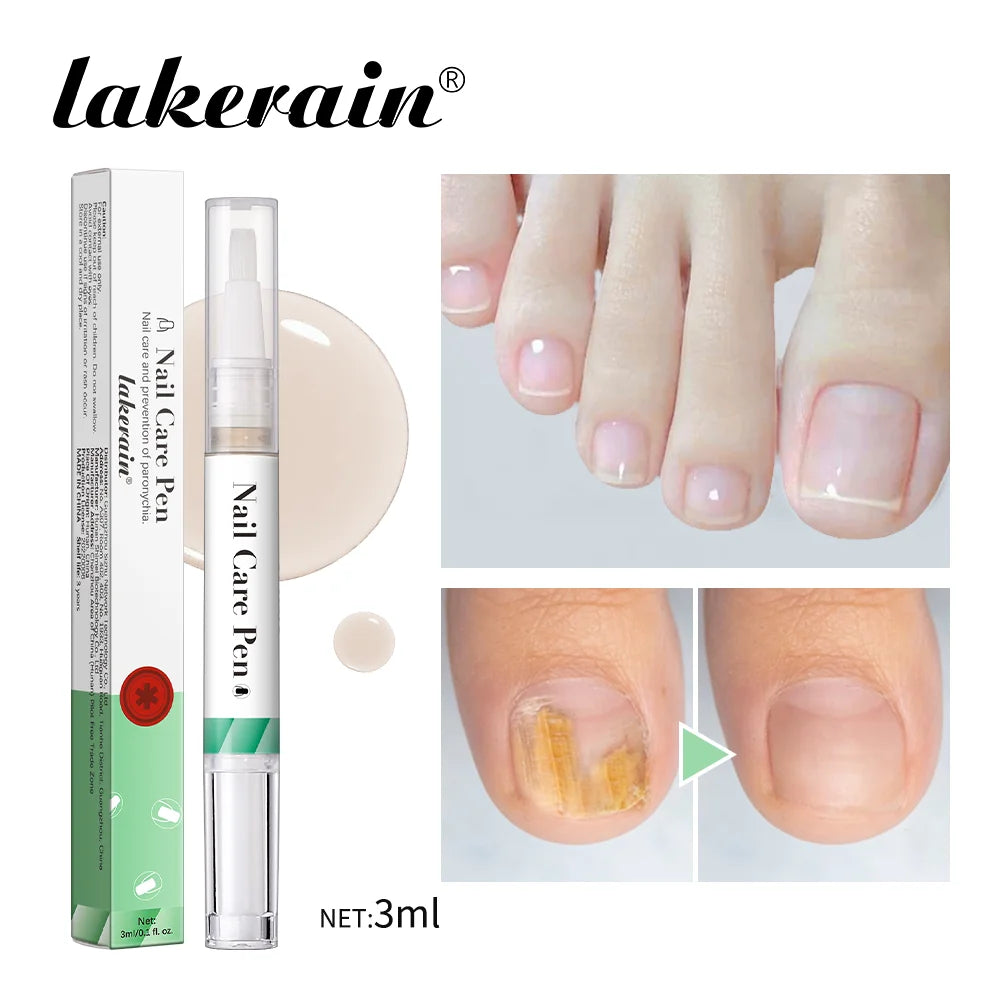 1/2pc Nail Care Mild Ingredients Prevent Damaged Nail Bed Treat Onychomycosis Nail Repair Pen For Nail Beauty Health Care Tools