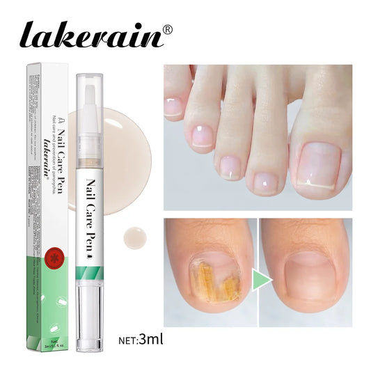 1/2pc Nail Care Mild Ingredients Prevent Damaged Nail Bed Treat Onychomycosis Nail Repair Pen For Nail Beauty Health Care Tools