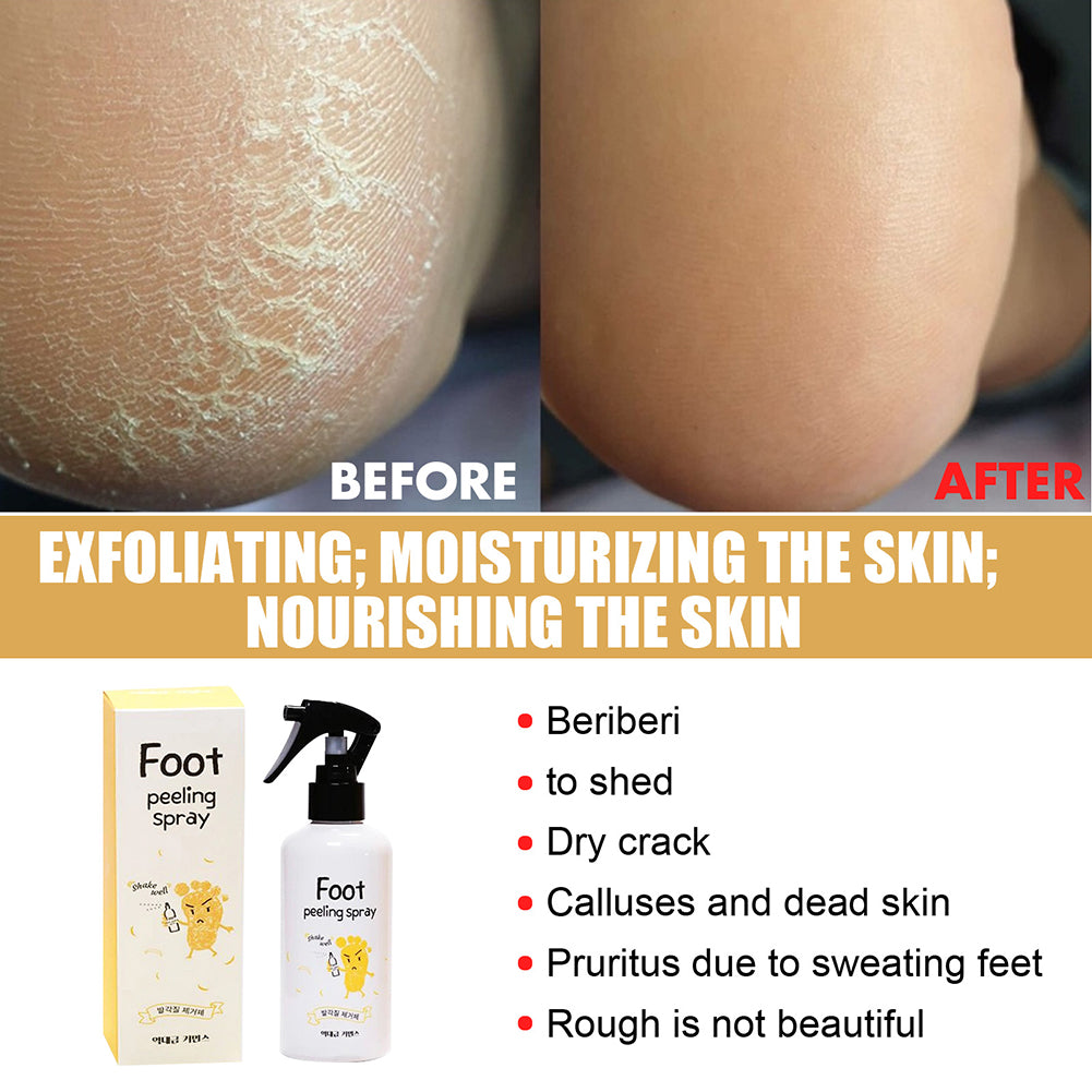 Foot Spray Exfoliate Nourish Moisturizing Skin Exfoliator File Feet Repair Dead Skin Rejuvenation For Foot Care For Women Men