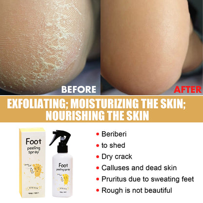 Foot Spray Exfoliate Nourish Moisturizing Skin Exfoliator File Feet Repair Dead Skin Rejuvenation For Foot Care For Women Men