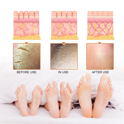 Jaysuing Exfoliating Foot Treatment Spray Remove Dead Skin Care Repair Skin Cracks Replenish Moisture Moisturize Soften Footcare