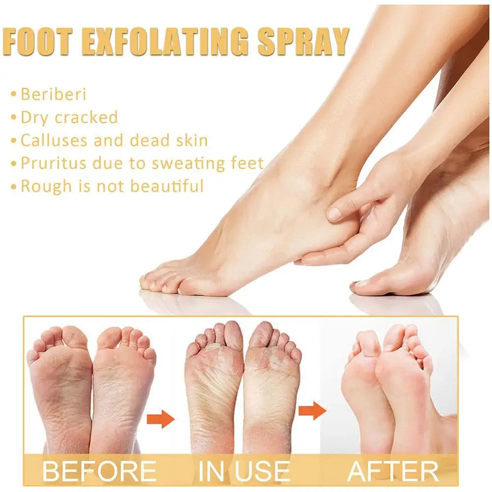 Foot Callus Remover Spray Quickly Soften Calluses Exfoliation Dry Feet Skin Hydrating clean Dead repair Skin cuticles Foot Care