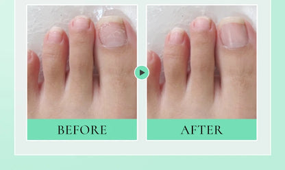 Nail Nourishment Cuticle Oil Pen Gel Suitable Hand/Feet Vitamin E Finger Nails Treatment Serum Nail Care