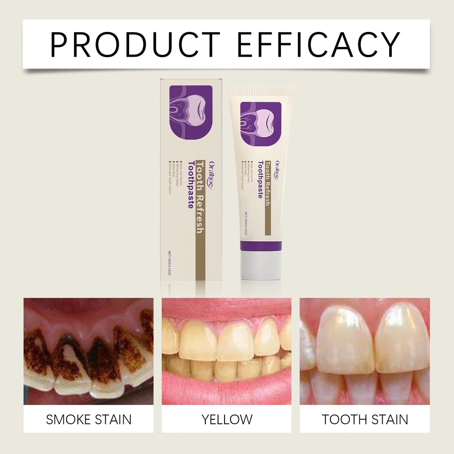 ORALHOE Tooth Stain Removal Toothpaste Refresh Breath Whiten Teeth Protect Gums Repair Enamel Maintain Healthy Boost Confidence