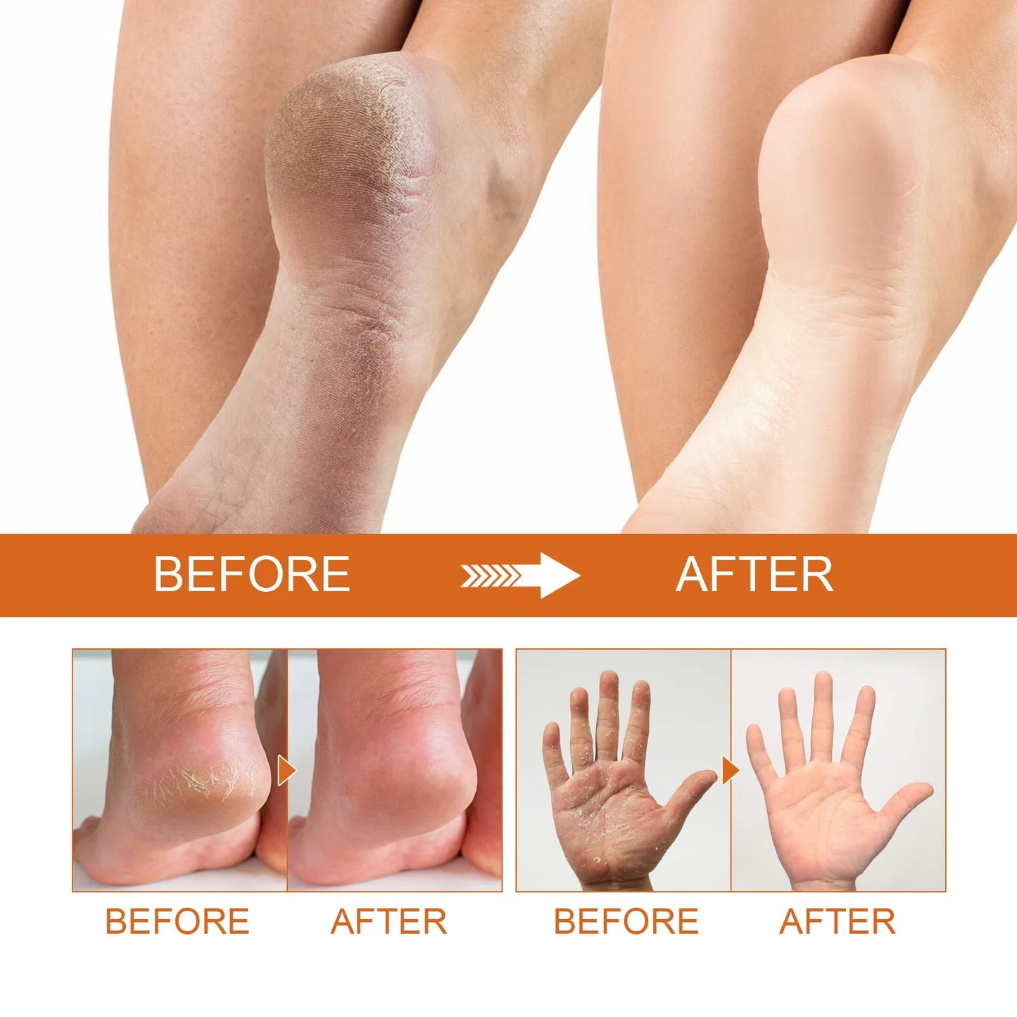 100ml Foot Peeling Spray Orange Essential Oil Exfoliating Nourish Peel Feet Calluses Dead Skin Remover Pedicure Foot Care Tool