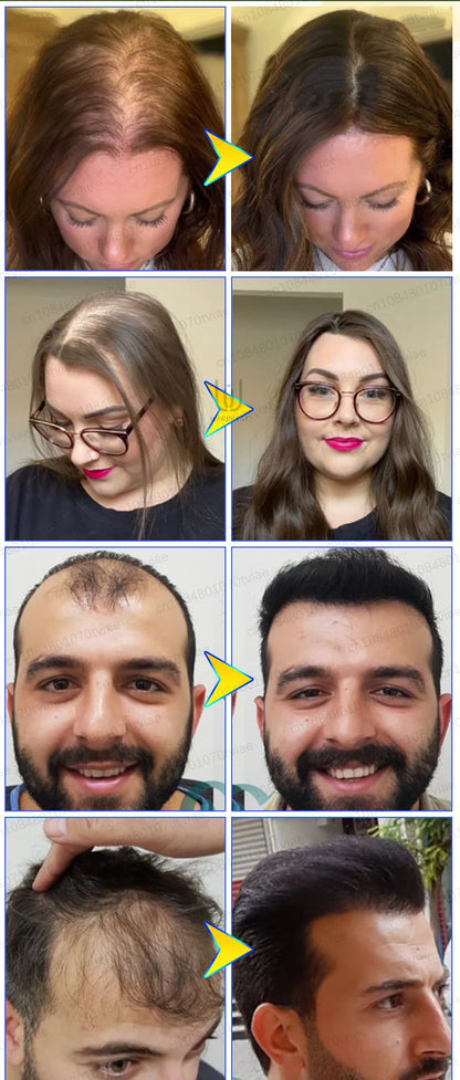 hair water spray, to meet the needs of most people