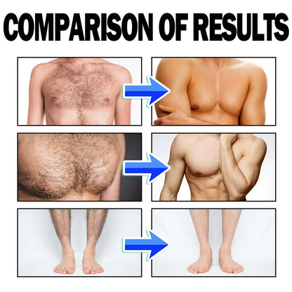 Powerful Hair Removal Mousse Permanent Painless Hair Remover for Men Armpit Legs Hair Growth Inhibitor Depilatory Cream Care