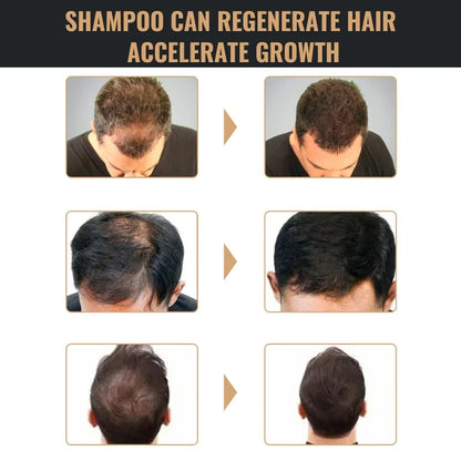 Hair Loss Treatment Shampoo Promote Growth Strengthen Hair Roots Scalp Repair Anti Thinning Moisturizing Thickening Hair Care