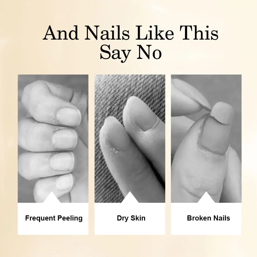 15ML Nail Cuticle Nutrient Oil Nourish Repair Damaged Nail Care Nutrition Oil Treatment Moisturizes Strengthen Bright for Nails