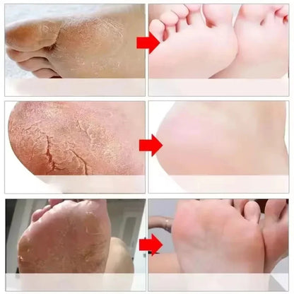 Herbal Anti Crack Foot Cream Peeling Spray Heel Cracking Repair Products Exfoliation Dead Skin Removal Softening Smooth Care