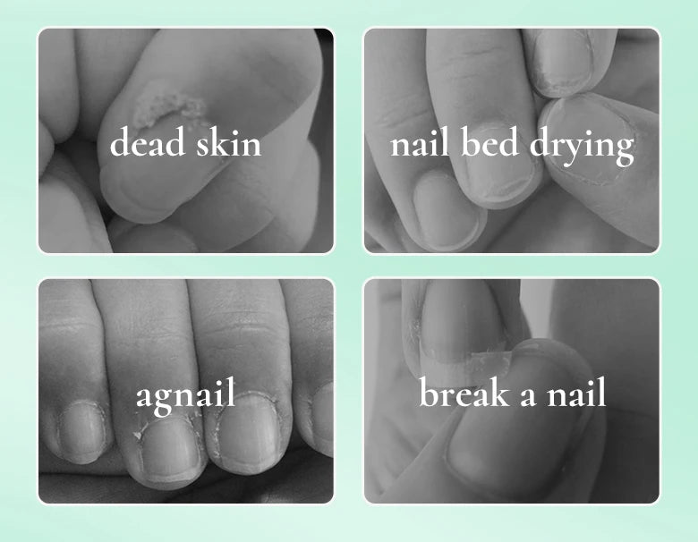 Nail Nourishment Cuticle Oil Pen Gel Suitable Hand/Feet Vitamin E Finger Nails Treatment Serum Nail Care